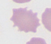 echinocyte