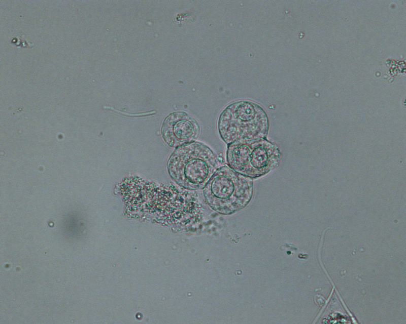 Epithelial Cells In Urine 1401