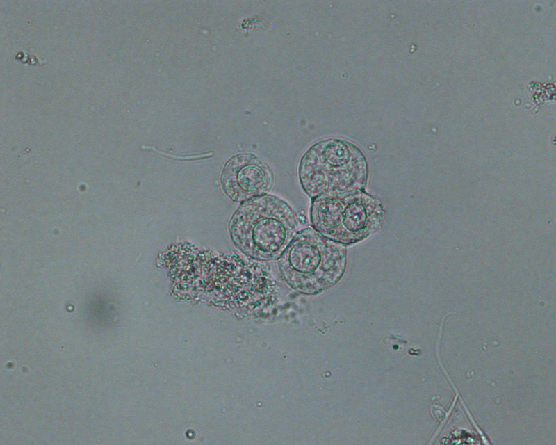 Epithelial Cells In Urine 9421