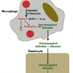 Extravascular hemolysis