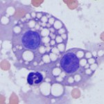 Fat droplets from a renal tubular epithelial cell in a cat.