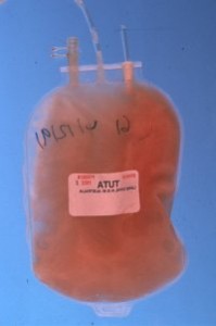 Plasma bag