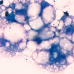 Hepatic lipidosis