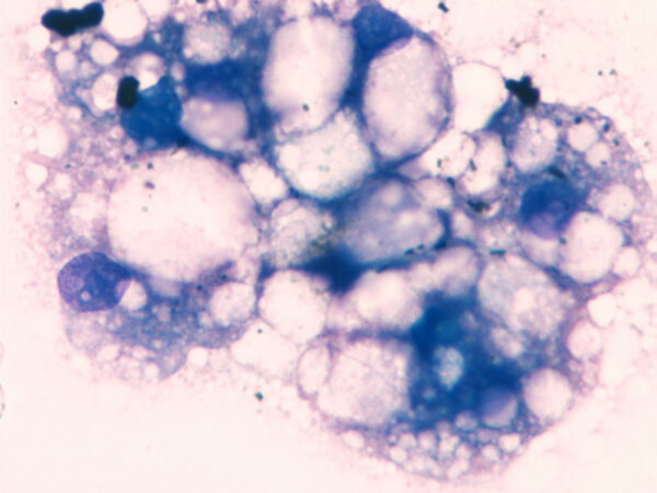 Hepatic lipidosis