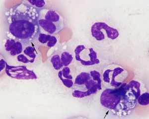 Histiocytes