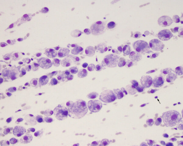 Reactive macrophages