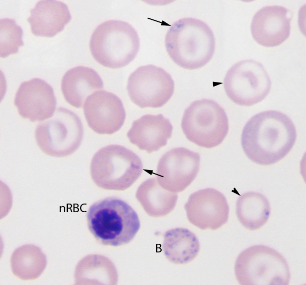 lead-poisoning-eclinpath