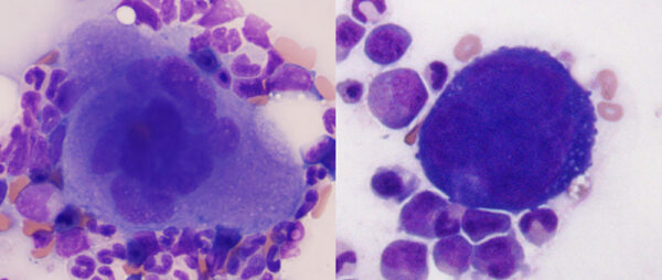 Megakaryocytes