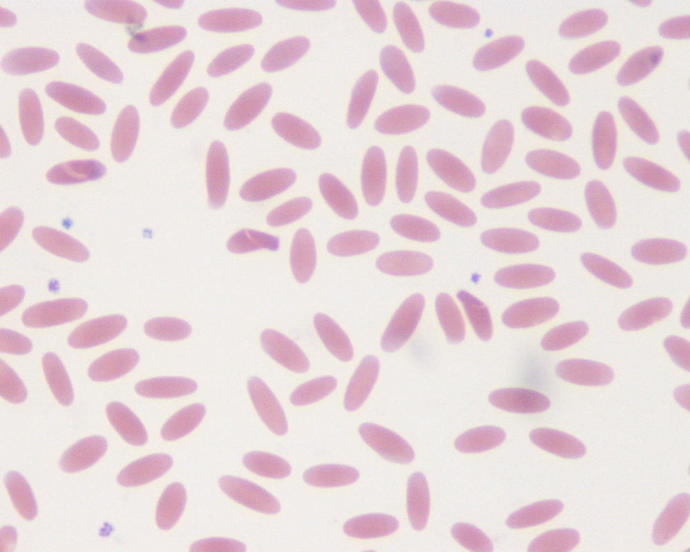 platelets microscope