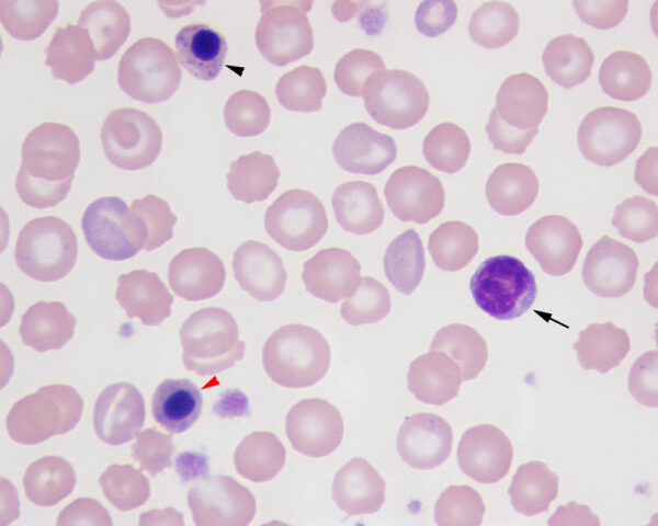 nRBC vs lymph