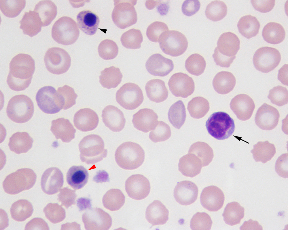 Nucleated red blood cells and lymphocytes | eClinpath