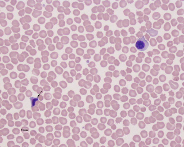 nrbc apoptotic