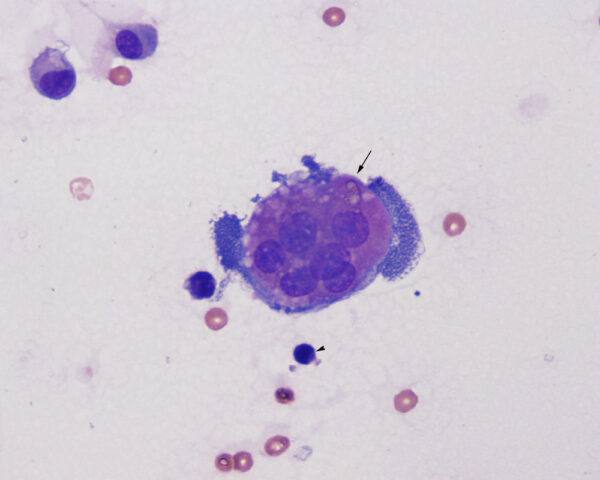 Osteoclast