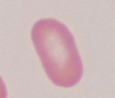 elliptocyte