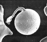 Electron microscopy of a pyknocytes with a membrane tag.