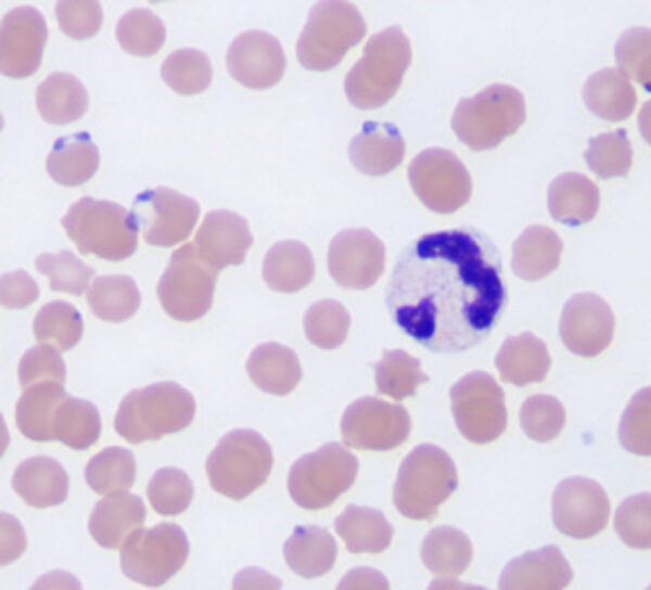 Babesia reindeer