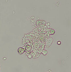 Renal epithelial cells | eClinpath