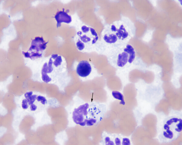 Joint sepsis