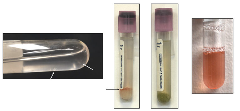 Tracheal Wash Tubes | EClinpath