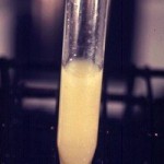 A sample of turbid urine