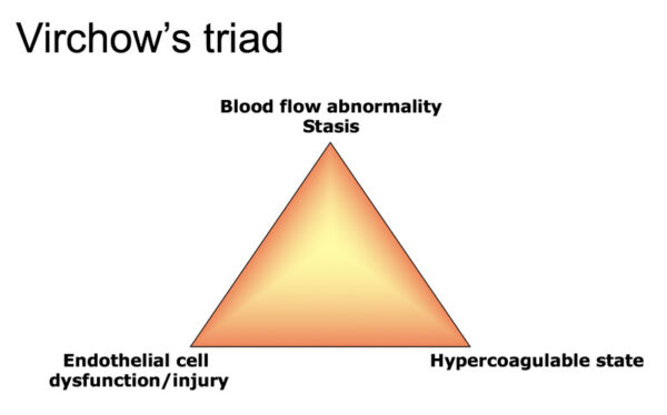 Virchow's triad